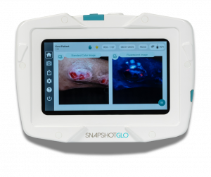 Device SnapshotGLO with clinical image and bacterial fluorescence image on the screen