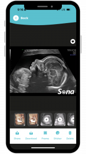 Sona app interface showing an ultrasound image securely shared from an OB/GYN practice to a patient’s smartphone.