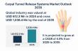 Carpal Tunnel Release Systems Market to Reach USD 1,036.4 Million by 2035 | Analysis Report by TMR