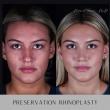 Renowned Facial Plastic Surgeon, Dr. Masoud Saman, Recognized as One of the Best Rhinoplasty Surgeons in New York City