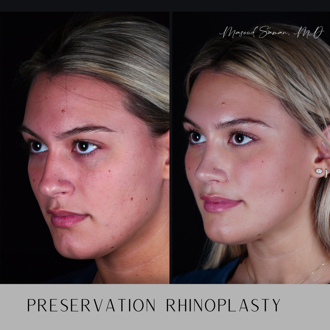 Renowned Facial Plastic Surgeon, Dr. Masoud Saman