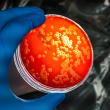 BioPathogenix Launches ‘Bacterium is Beautiful’ Visual Experience to Celebrate Science