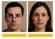 InjectCo’s new Botox and filler calculator helps clients estimate treatment needs