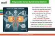 Global PCOS Treatment Market to Reach US$ 4.6 Bn by 2030, Driven by Rising Prevalence and Innovation