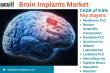 United States Brain Implants Market Set to Revolutionize Neurotechnology: Cutting-Edge Innovations and Rapid Growth 2025