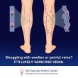 Vascular Physician Sheds Light on Varicose Vein Treatments
