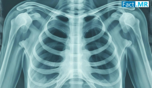 The global smart chest patches market is set on a rapid growth trajectory, fueled by rising adoption in cardiac monitoring, respiratory care, fitness, and chronic disease management Smart Chest Patches Market