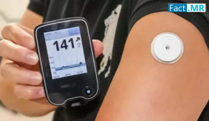 The global implantable glucose monitors market is on a rapid growth trajectory, driven by rising demand for advanced diabetes management solutions, real-time monitoring technologies, and longer-lasting devices Implantable Glucose Monitors Market