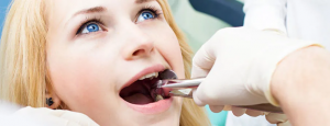 wisdom teeth removal cost Australia