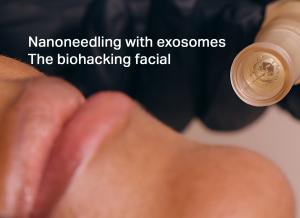 Santa Monica CA - October 8, 2025 nanoneedling, exosomes, facial, skincare