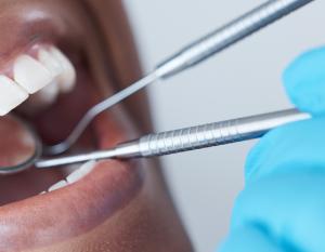 Sterling Periodontics and Implantology is proud to highlight its professional periodontal care, offering advanced periodontal treatment, emergency dentistry, and sedation dentistry for patients across Beverly Hills and the surrounding communities Woman with her mouth open next to a gloved hand holding dental tools.