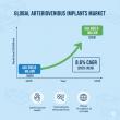 Arteriovenous Implants Market to Surpass USD 650 Million by 2035, Driven by Rising End-Stage Renal Disease Cases