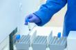 KFSHRC Pioneers Gene Therapy with Local Production of T-Cells and Plans to Scale Up to 100 Treatments Annually