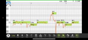 23957649 vocaloid user interface image