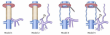 Resecting the Unresectable — Advances in Extracorporeal Liver Surgery (ELS)