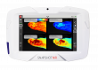 Kent Imaging's SnapshotNIR, showcasing at Wounds UK, Sets New Benchmark for Tissue Viability Imaging in the UK Market 