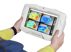 SnapshotNIR KD205 hemoglobin view with hands