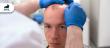 Red Flags to Watch for When Choosing a Hair Transplant Clinic