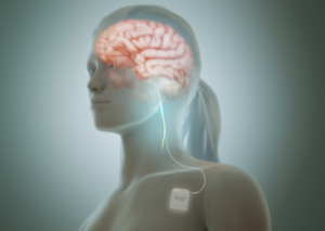 Vagus Nerve Massager Diagram