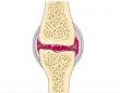 cPLA2 Inhibition with Fexofenadine Protects Cartilage in Degenerative Joint Disease