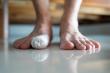 New Orleans–Area Physicians Warn That Untreated Ingrown Toenails Can Lead to Serious Infections