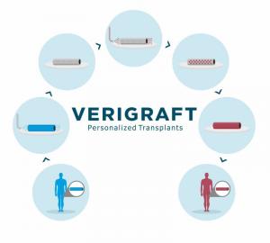 Graphic illustration of VERIGRAFT’s Personalized Tissue-Engineered Vein (P-TEV) showing the process of creating a patient-specific vein graft.