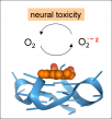 A G-quadruplex-hemin peroxidase complex as a source of oxidative stress in neurological diseases