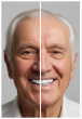 Best Snap-On Veneers for Seniors with Missing Teeth Consumer Reports Released by OSHF