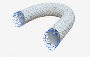 Solaris Endovascular, Inc., a medical device company developing next-generation covered stent technologies, today announced that the DEScover Clinical Trial has successfully completed enrollment