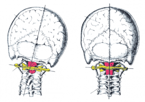 upper cervical chiropractic