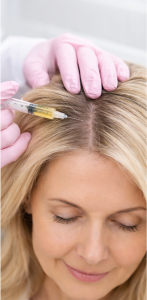 Dutasteride Mesotherapy In Kitchener-Waterloo