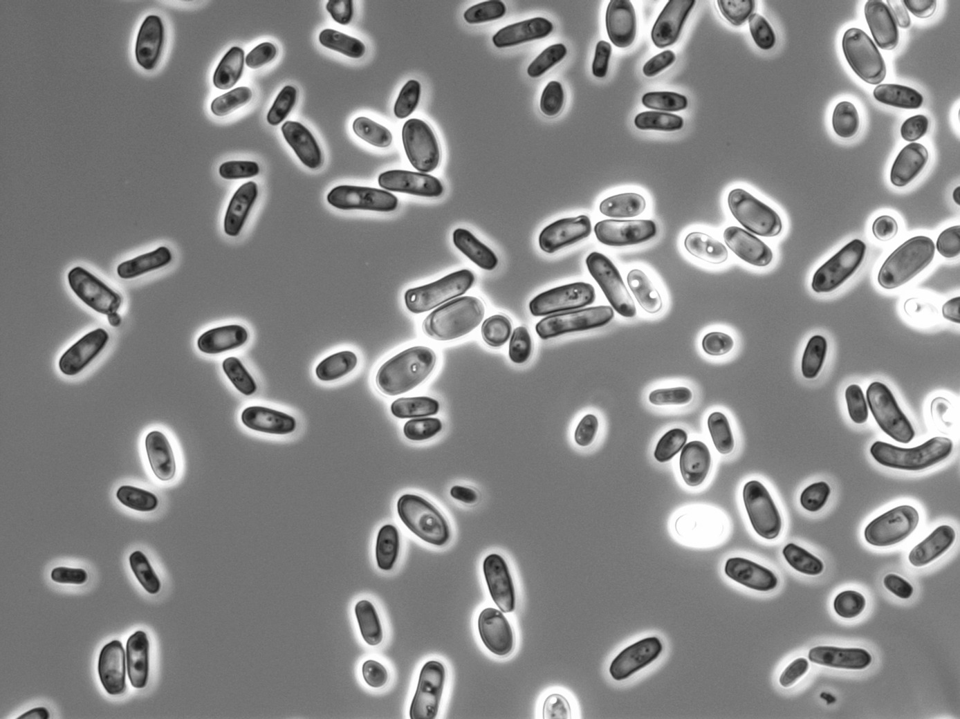 Dangerous fungal infections – Leibniz Institute DSMZ provides foundation for their investigation