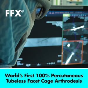 SC MEDICA Announces World’s First 100% Percutaneous, Tubeless Facet Cage Arthrodesis with FFX Facet FiXation system