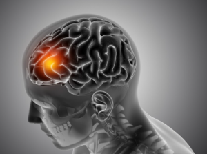 brain health company Red Deer, Alberta