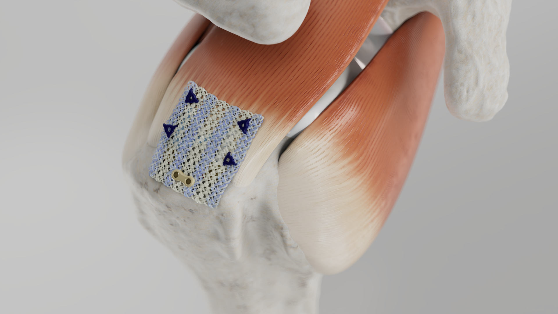 Icons of the 2020s: How Cars Became Symbols of a Changing Era - Florida ...