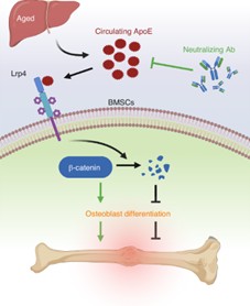A Non-invasive Therapeutic Strategy for Improving Bone Healing in Aged Patients