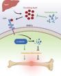 A Non-invasive Therapeutic Strategy for Improving Bone Healing in Aged Patients 