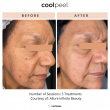 Sibél Aesthetics Introduces CoolPeel™ CO₂ Laser Resurfacing for Advanced Skin Rejuvenation With Minimal Downtime