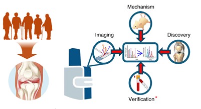 New Molecular Maps of Bone Could Transform Early Osteoarthritis Detection