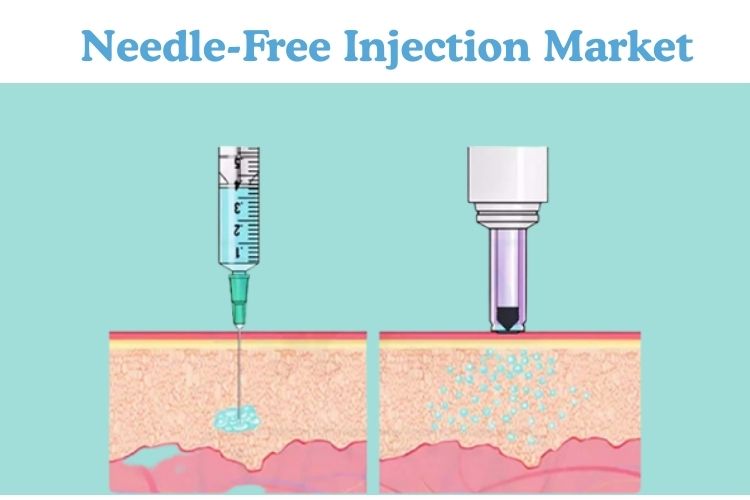 Global Needle-Free Injection Market to Grow at 15% CAGR Through 2031 Driven by Diabetes Care and Vaccine Demand