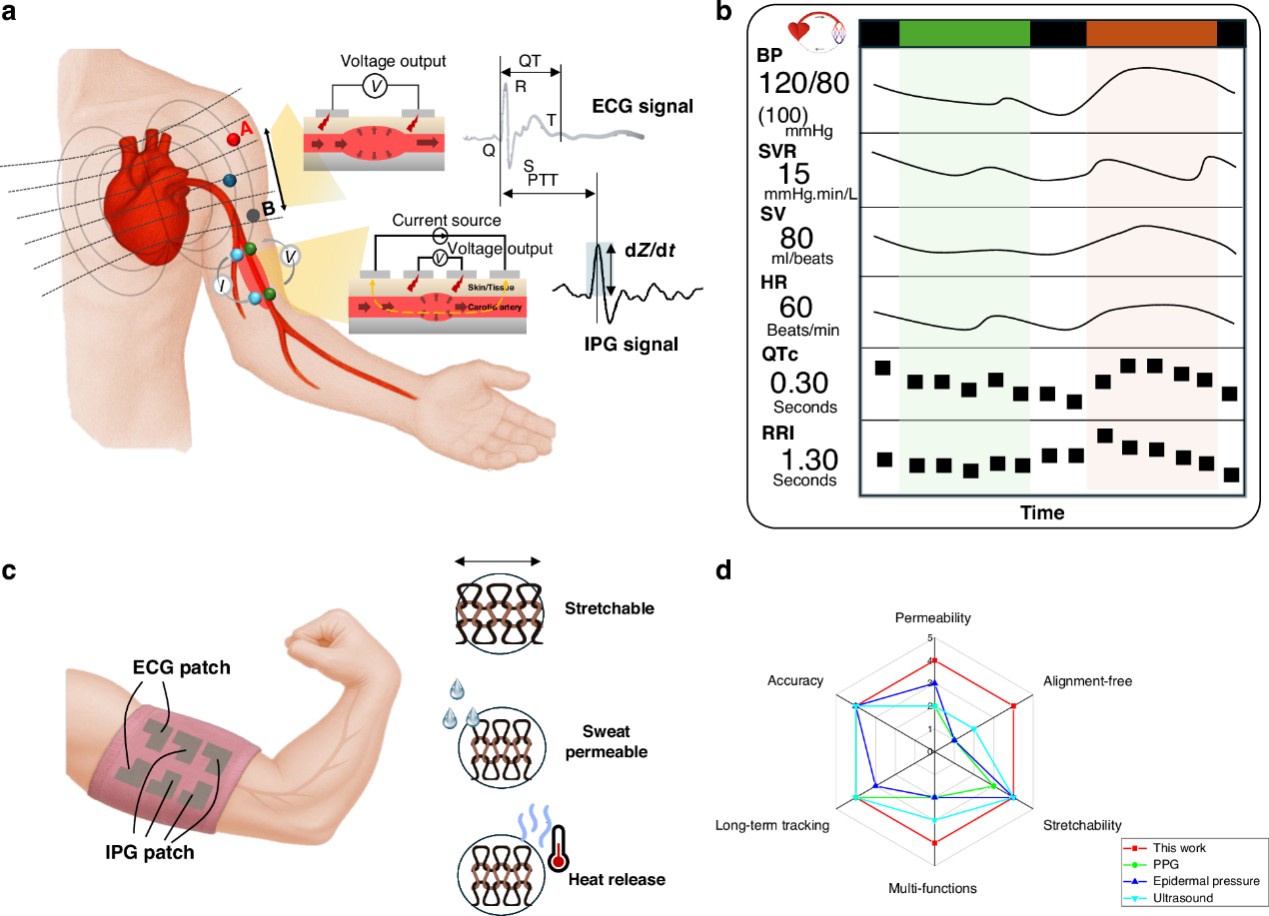 A wearable textile sensor sets new standard for continuous heart and vessel monitoring