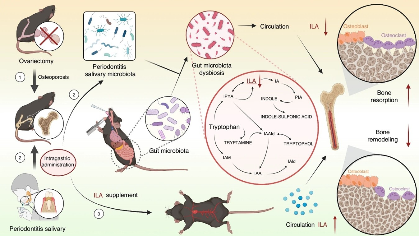 How Periodontitis-Linked Bacteria Accelerate Osteoporosis-Like Bone Loss Through the Gut