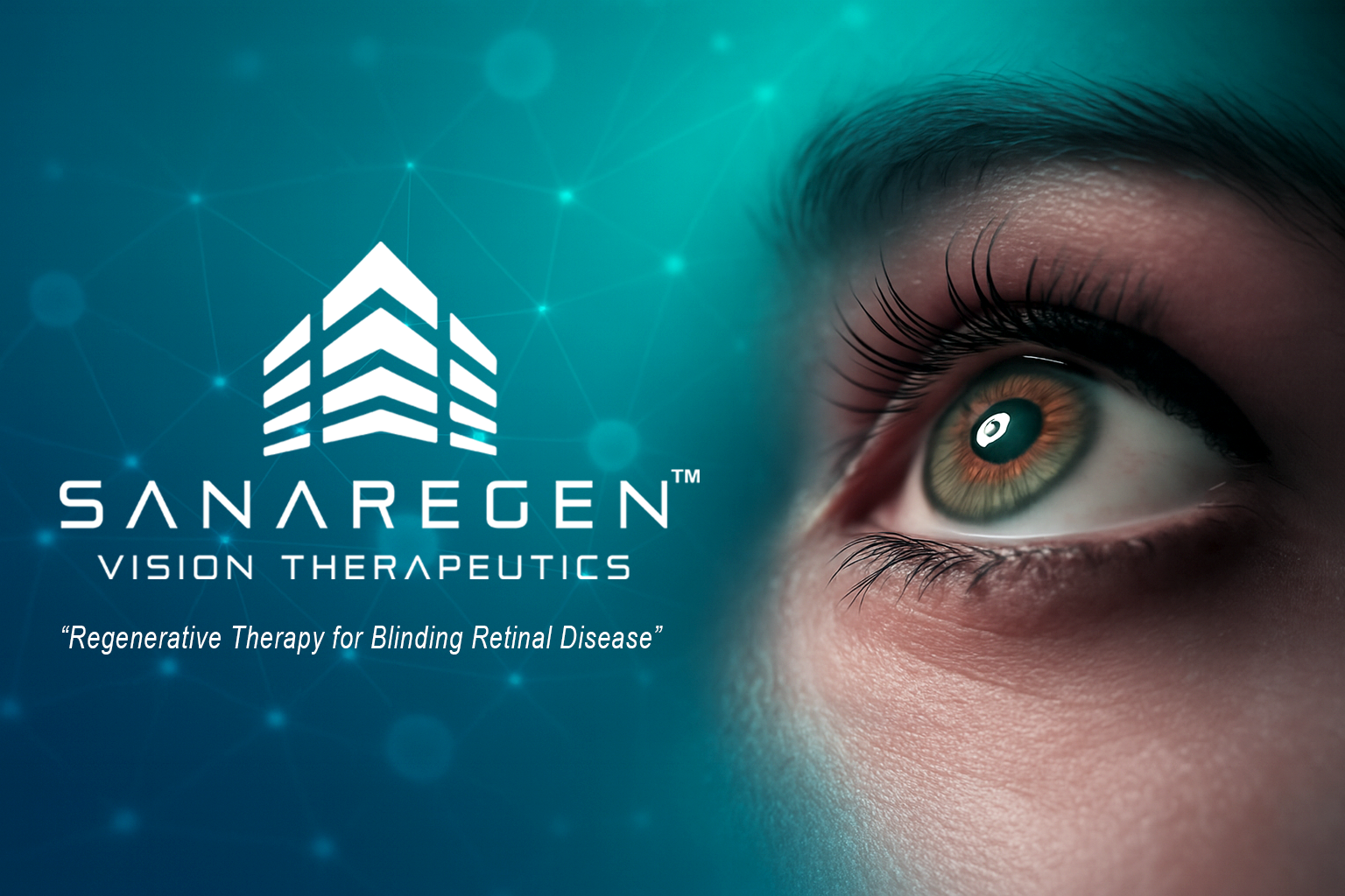 Sanaregen™ Vision Therapeutics Receives FDA Clearance for Clinical Trial to Treat Retinal Degeneration