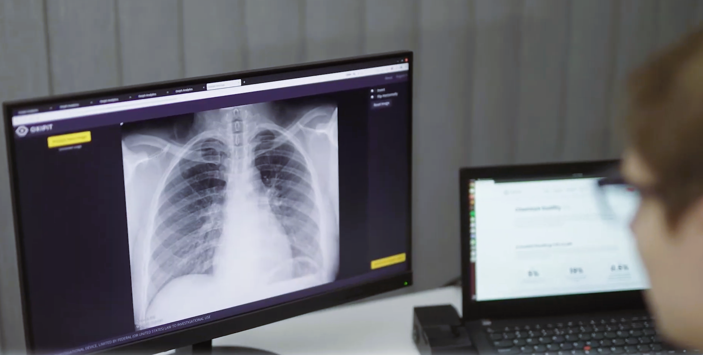 Oxipit enters agreement to be acquired by Sectra to scale autonomous AI in radiology