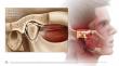 LOXL2 Enzyme Discovery Offers New Hope for Jaw Arthritis