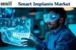 Smart Implants Market Surges as AI, Sensors, and Wireless Monitoring Transform Modern Implantable Medical Devices