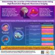 Chinese Neurosurgical Journal Study Develops a New Protocol for Determining Location of Paraclinoid Aneurysms