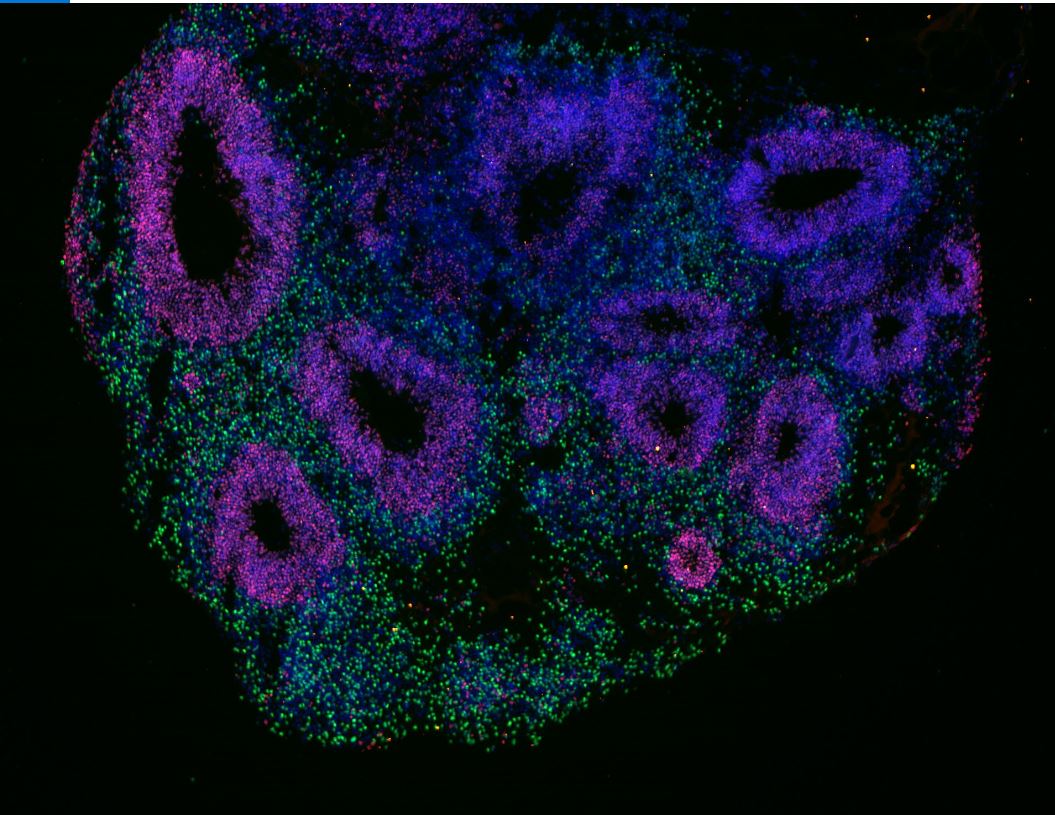 New Study Identifies Key Protein Behind Myelin Repair Failure in Multiple Sclerosis