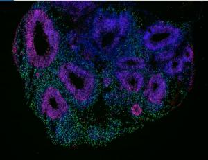 Cerebral Organoid
