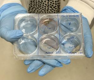 Cerebral Organoid naked eye